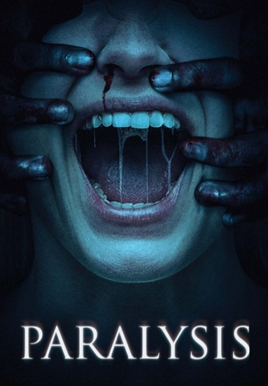 Paralysis